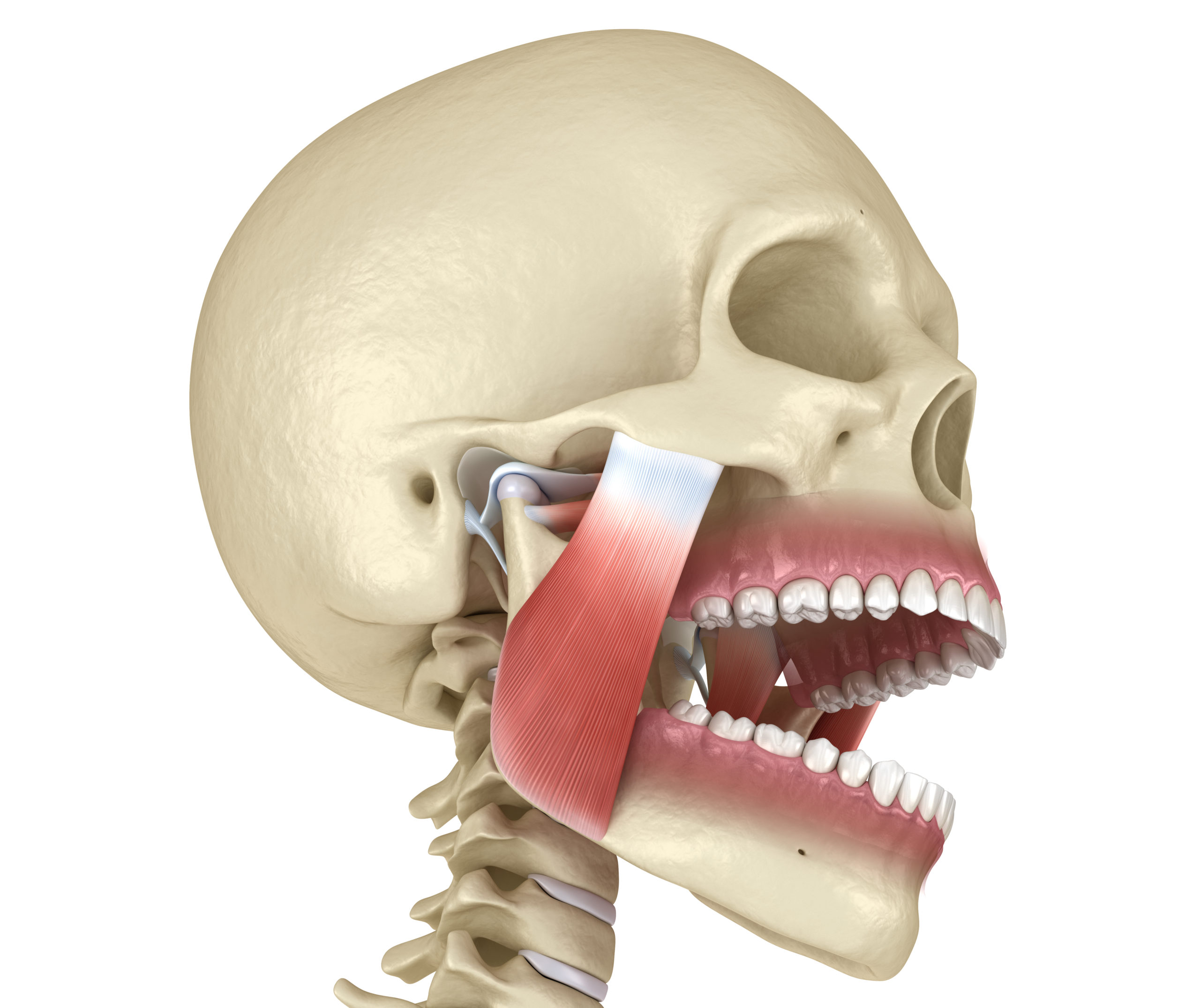 What is TMD (Temporomandibular Joint Disorder)?