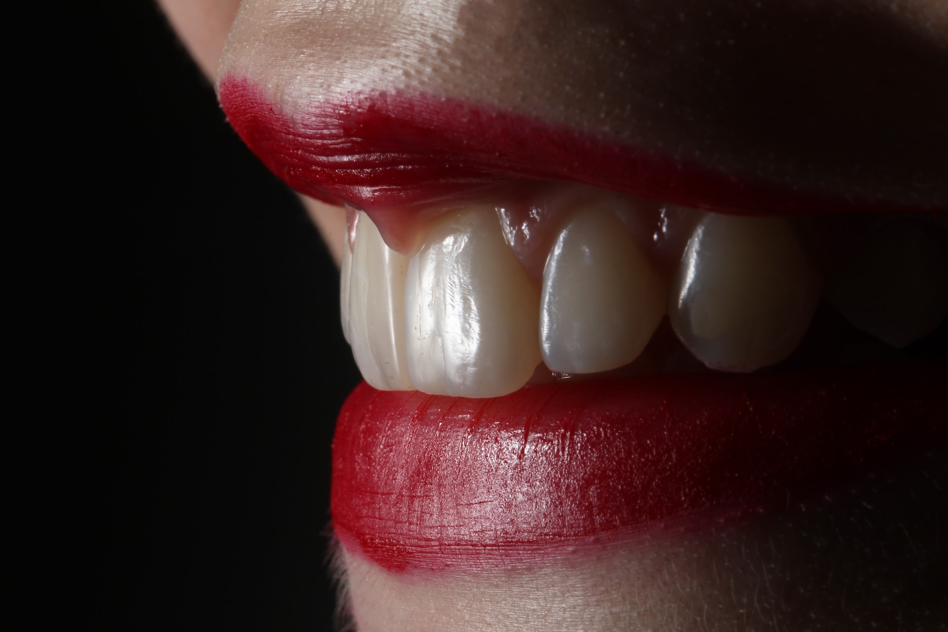 Illuminating Smiles: Unveiling Brisbane’s Premier Teeth Whitening Options