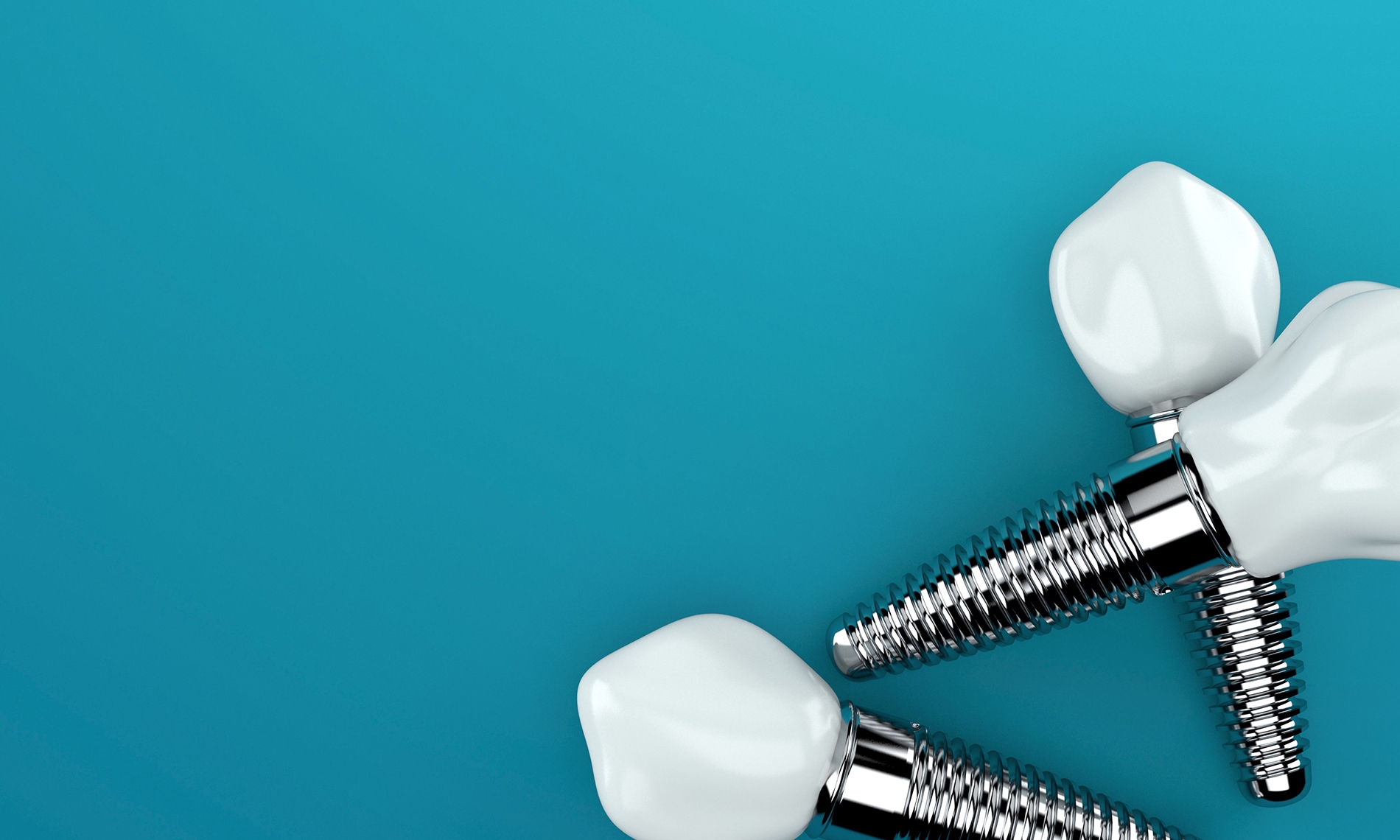 Navigating the Comfort Journey: Do Dental Implants Hurt?