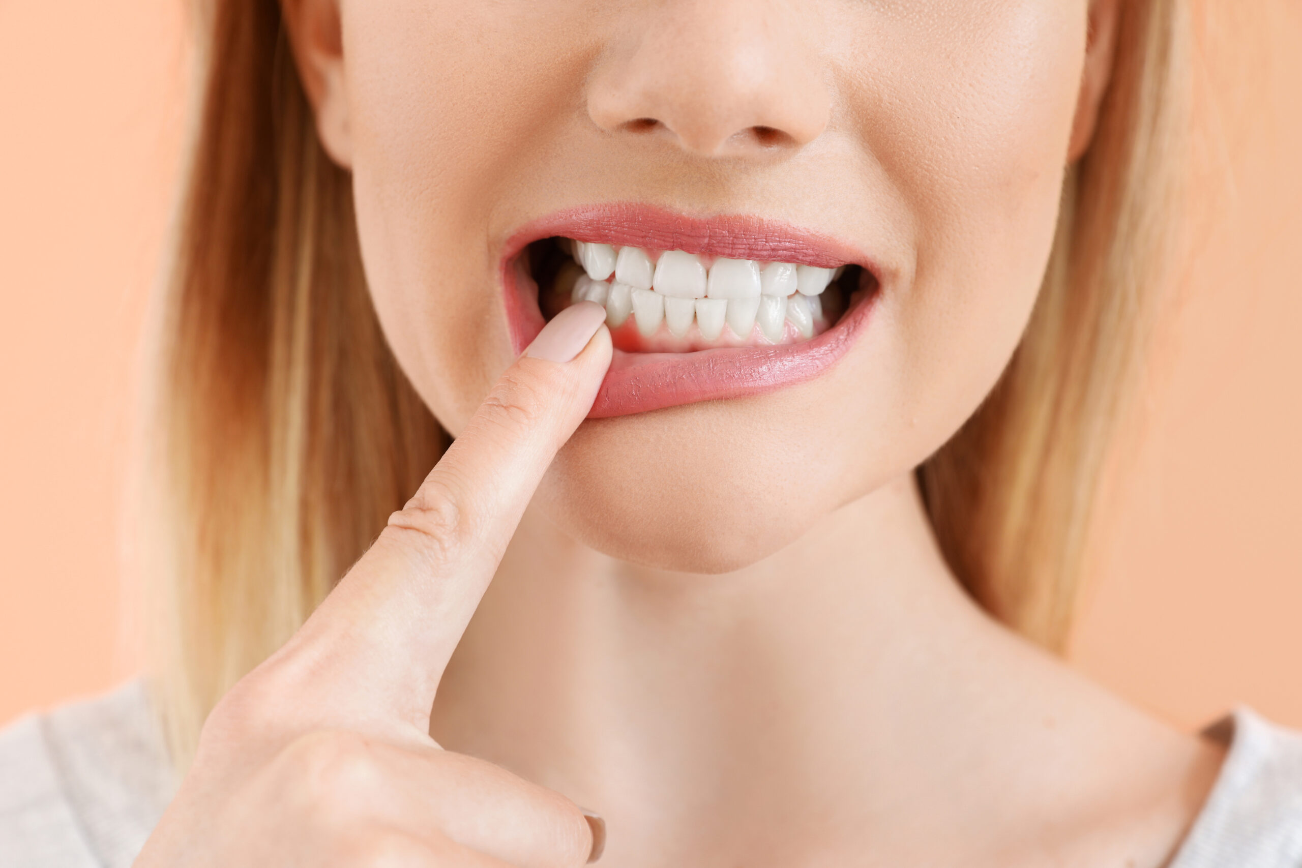 How To Treat Burned Gums From Teeth Whitening?